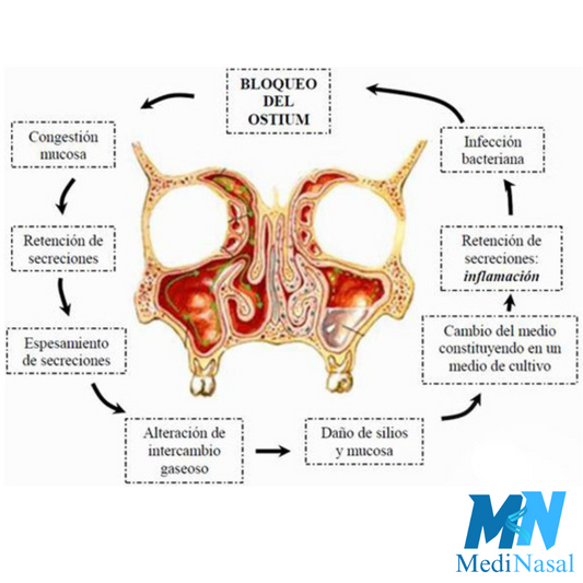 La ciencia detrás del enjuague nasal: cómo funciona y por qué es eficaz