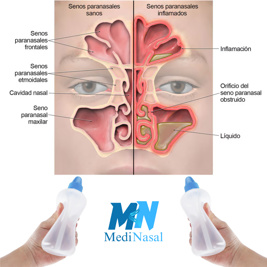 Beneficios del lavado nasal y enjuague nasal